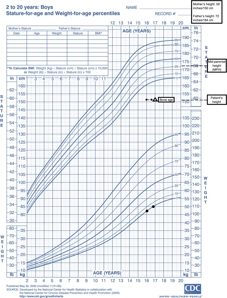 Short Stature in Klinefelter Syndrome From Aggrecan Mutation.