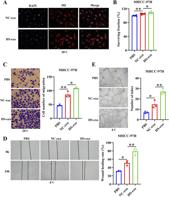 Exosomal circPTPRK promotes angiogenesis after radiofrequency ablation in hepatocellular carcinoma.