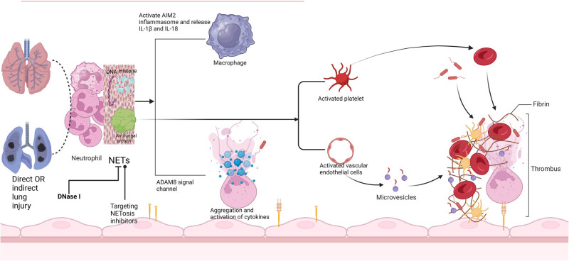 Progress in cytokine research for ARDS: A comprehensive review.