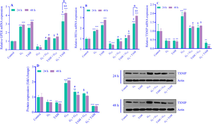 The activation of the G-protein-coupled estrogen receptor promotes the aggressiveness of MDA-MB231 cells by targeting the IRE1α/TXNIP pathway.