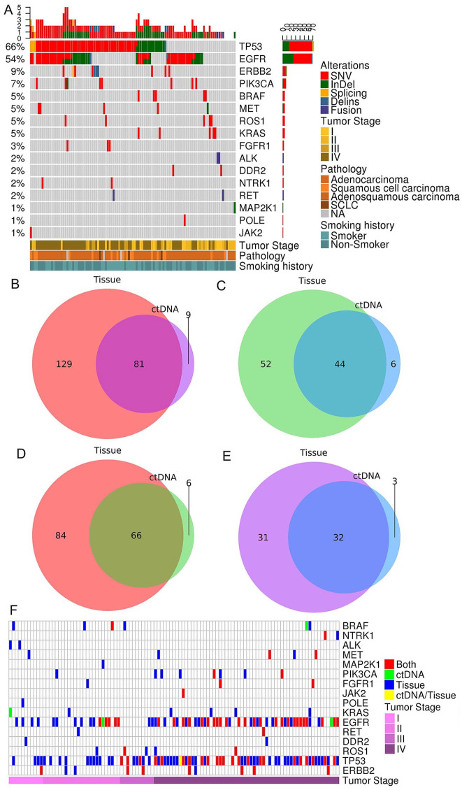 Utility of Circulating Tumor DNA Assay in Identifying Mutations and Guiding Matched Targeted Therapy in Lung Cancers.