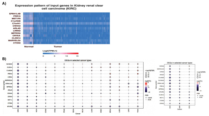 Bioinformatic Approaches for the Identification of Novel Tumor Suppressor Genes and Cancer Pathways in Renal Clear Cell Carcinoma.