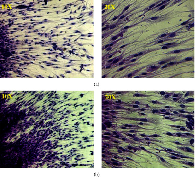 Evaluation of Random and Aligned Polycaprolactone Nanofibrous Electrospun Scaffold for Human Periodontal Ligament Engineering in Biohybrid Titanium Implants.