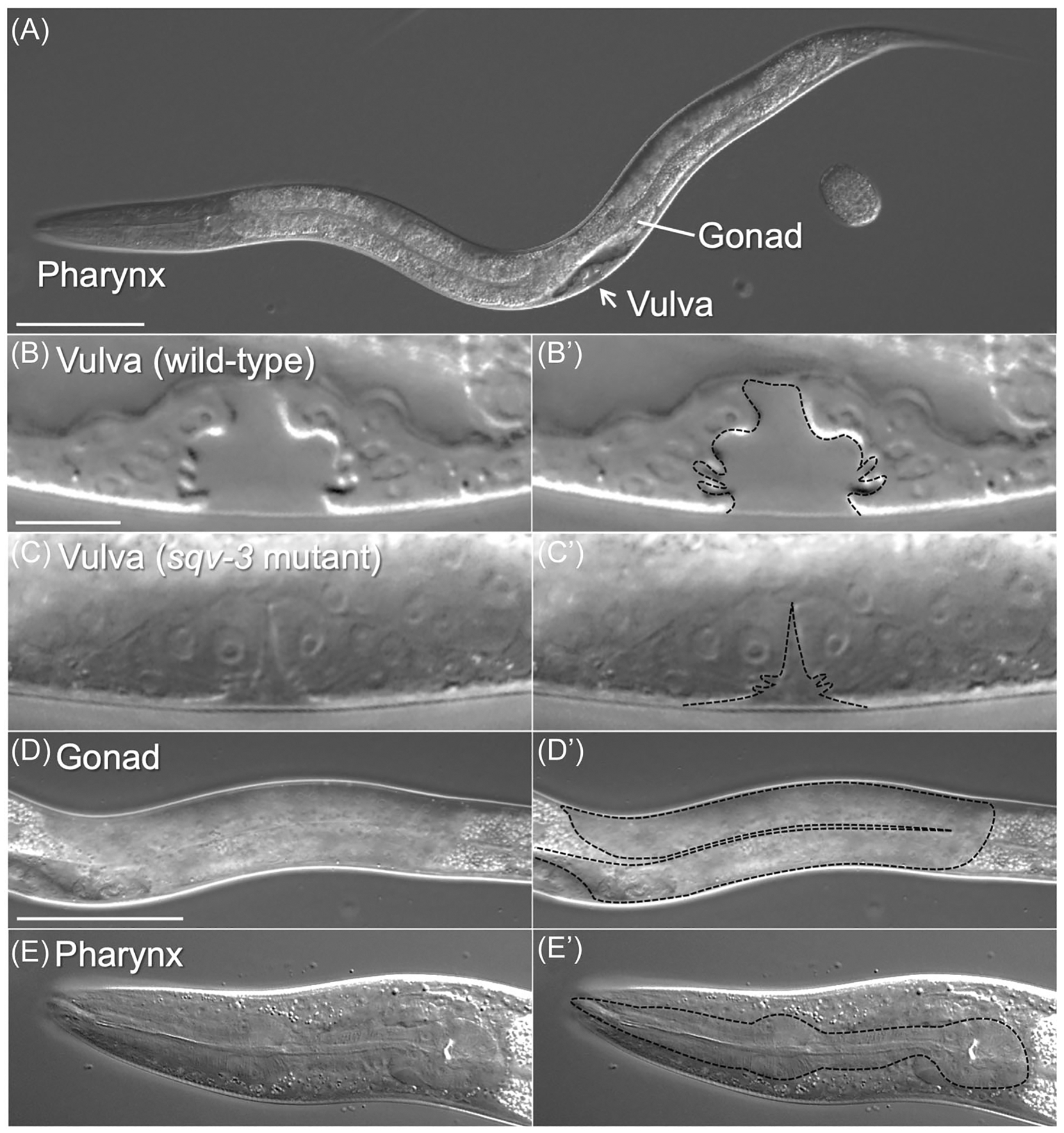 Chondroitin sulfate in invertebrate development.
