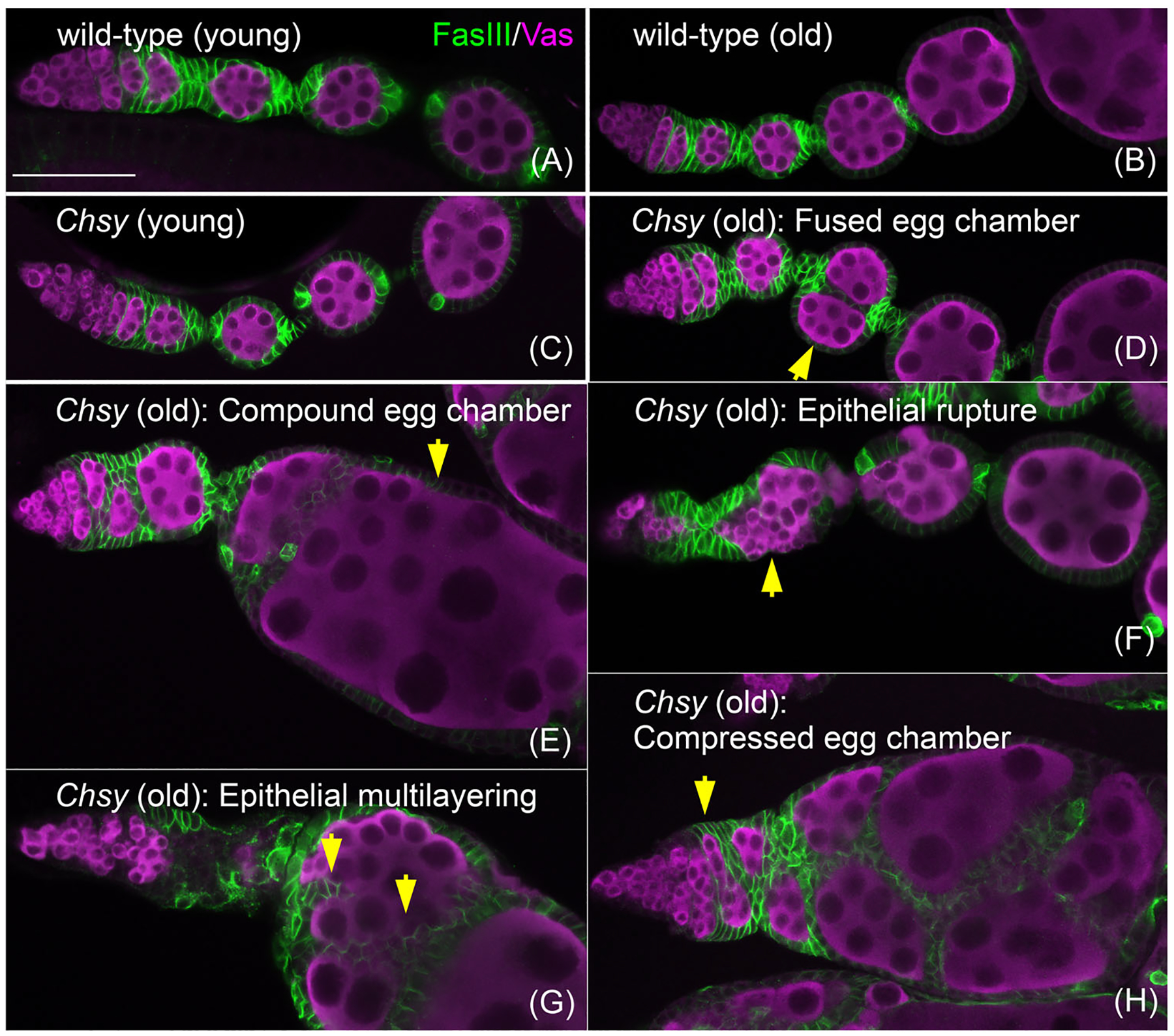 Chondroitin sulfate in invertebrate development.