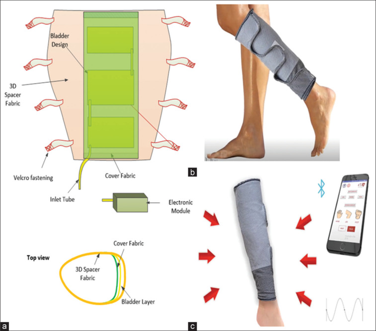 A Randomized Controlled Trial to Compare the Effectiveness of Smart Dynamic Fabric Actuator with Exercises in Chronic Musculoskeletal Leg Pain Associated with Prolonged Standing in a Hospital Setting.