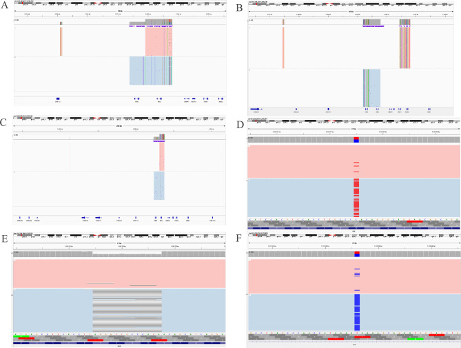 Application of third-generation sequencing technology for identifying rare α- and β-globin gene variants in a Southeast Chinese region.