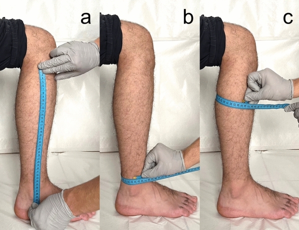 Relationship between peroneus longus tendon graft thickness and anthropometric variables: a radiographic study using ultrasonography.
