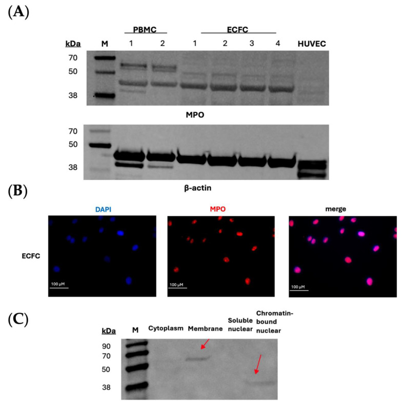 Expression of Myeloperoxidase in Patient-Derived Endothelial Colony-Forming Cells-Associations with Coronary Artery Disease and Mitochondrial Function.