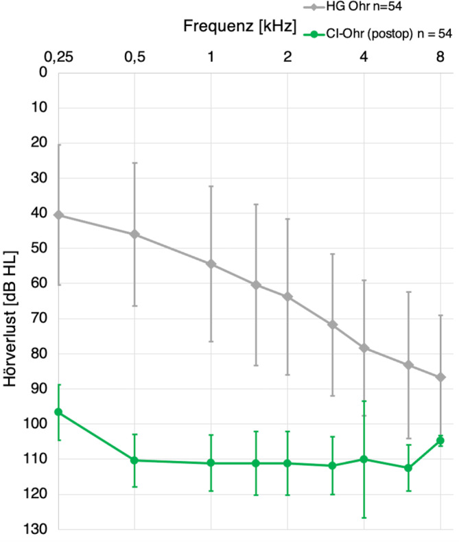 [Audiological outcome of bimodal CI users over time and depending on different influencing factors].