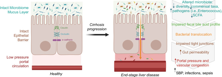 Infections in decompensated cirrhosis: Pathophysiology, management, and research agenda.