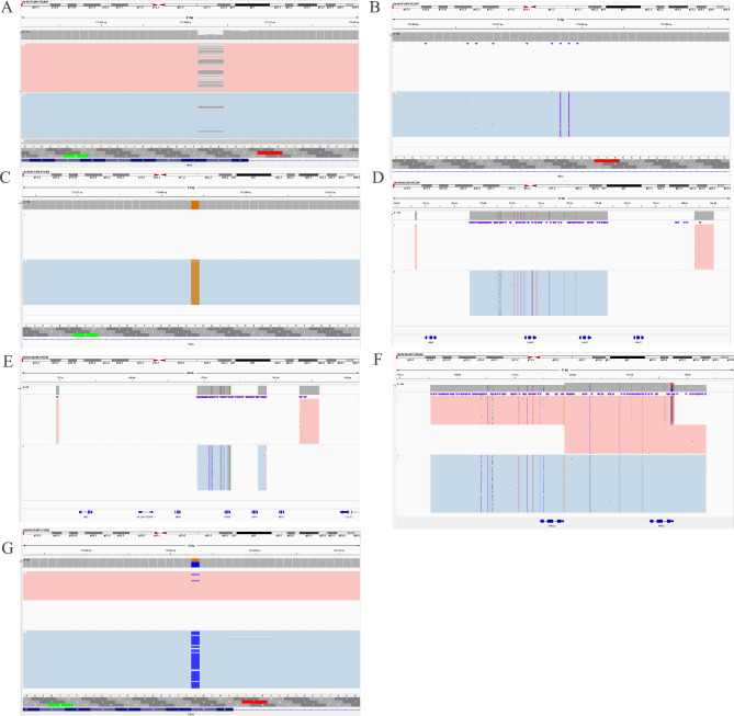 Application of third-generation sequencing technology for identifying rare α- and β-globin gene variants in a Southeast Chinese region.