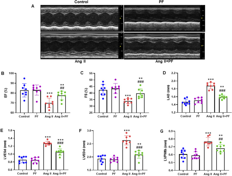 Paeoniflorin Inhibits Atrial Fibrosis and Atrial Fibrillation in Angiotensin II-Infused Mice Through the PI3K-Akt Pathway.