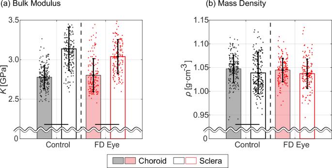 Biomechanical changes occur in myopic choroidal stroma and mirror those in the adjacent sclera