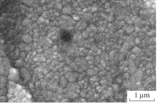 Ceramic Materials Based on a Complex Oxide Solid Solution of a Tetragonal Form of Zirconia: Application in Prosthetic Dentistry