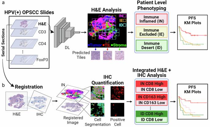 Integrative analysis of H&E and IHC identifies prognostic immune subtypes in HPV related oropharyngeal cancer