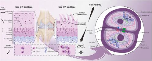 From polarity to pathology: Decoding the role of cell orientation in osteoarthritis