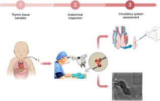 Microsurgical assessment of thymus vascular anatomy