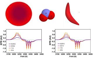 Nitrosyl Hemoglobin Formation from Nitrite in Normal and Sickle Blood