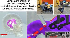 Comparative analysis of spatiotemporal playback manipulation on virtual reality training for External Ventricular Drainage