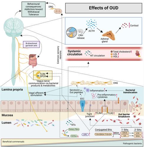 Understanding the impact of the gut microbiome on opioid use disorder: Pathways, mechanisms, and treatment insights