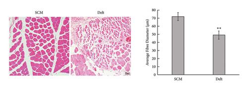 Negative Effects of Cx43 during Denervated Skeletal Muscle Atrophy Can Be Attenuated by Blueberry Extracts via Regulating Akt Pathway