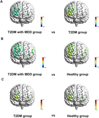 Characteristic Changes of Prefrontal and Motor Areas in Patients with Type 2 Diabetes and Major Depressive Disorder During a Motor Task of Tai Chi Chuan: A Functional Near-Infrared Spectroscopy Study