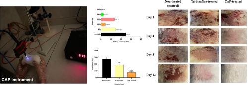 Cold atmospheric plasma as a promising tool in treatment of Trichophyton rubrum-induced skin infection in a guinea pig model of experimental dermatophytosis