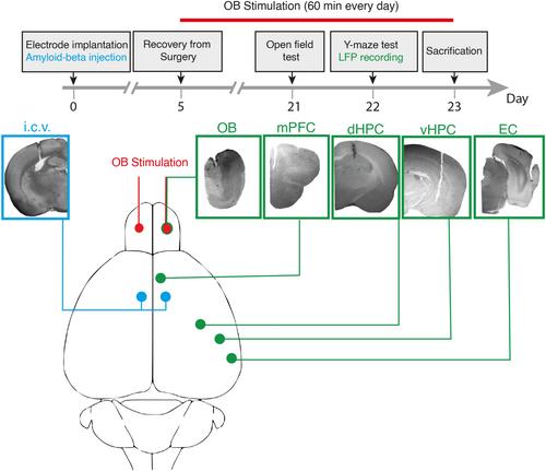 Olfactory bulb stimulation mitigates Alzheimer's-like disease progression