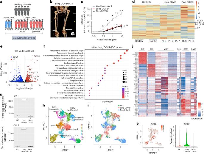 CCL2-mediated endothelial injury drives cardiac dysfunction in long COVID