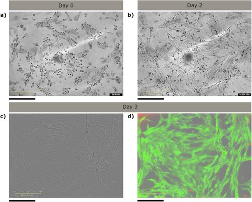 Development of a Human Recombinant Collagen for Vat Polymerization-Based Bioprinting