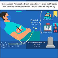 The impact of externalized pancreatic stents in our practice: A comparison of outcomes after pancreaticoduodenectomy in two time periods