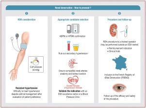 Catheter-based renal denervation in the treatment of arterial hypertension: An expert consensus statement on behalf of the French Society of Hypertension (SFHTA), French Society of Radiology (SFR), French Society of Interventional Cardiology (GACI), French Society of Cardiology (SFC), French Association of Private Cardiologists (CNCF), French Association of Hospital Cardiologists (CNCH), French Society of Thoracic and Cardiovascular Surgery (SFCTCV) and French Society of Vascular and Endovascular Surgery (SCVE)