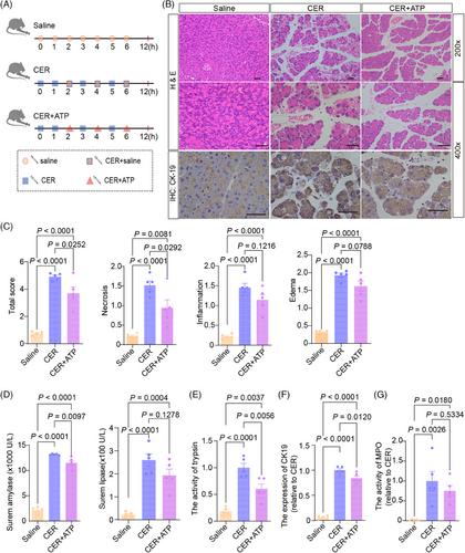 Vitamin B12 protects necrosis of acinar cells in pancreatic tissues with acute pancreatitis