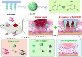 Metal–phenolic nanozyme based microneedle patch with antibacterial and antioxidant for infected wound healing