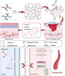 Exosomes from hypoxic urine-derived stem cells facilitate healing of diabetic wound by targeting SERPINE1 through miR-486-5p