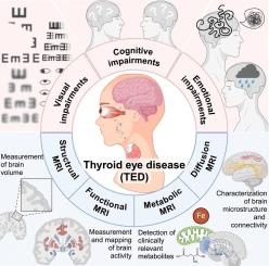 Neuroimaging in thyroid eye disease: A systematic review