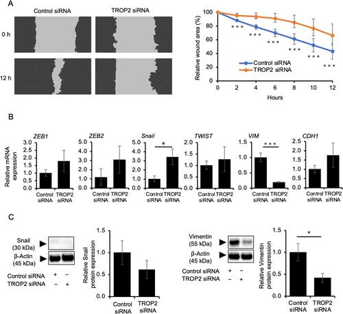 TROP2 Expression and Therapeutic Implications in Cutaneous Squamous Cell Carcinoma: Insights From Immunohistochemical and Functional Analysis