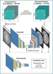 Reconstruction of reflection ultrasound computed tomography with sparse transmissions using conditional generative adversarial network