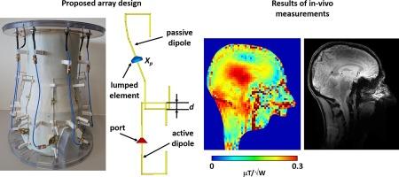 An array of paired folded-end dipoles for whole-brain imaging at 9.4 T