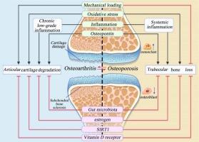 The interplay between osteoarthritis and osteoporosis: Mechanisms, implications, and treatment considerations – A narrative review