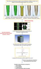 Three-dimensional finite element analysis of stress distribution on different complex macro designs in commercially available implants: An in-vitro study