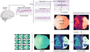 Probabilistic and explainable modeling of Phase–Phase Cross-Frequency Coupling patterns in EEG. Application to dyslexia diagnosis