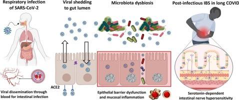 Gastrointestinal pathophysiology in long COVID: Exploring roles of microbiota dysbiosis and serotonin dysregulation in post-infectious bowel symptoms