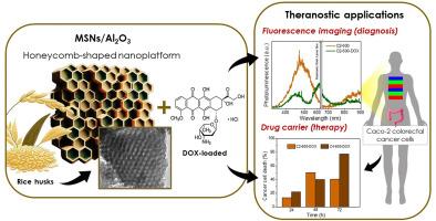 Multifunctional nanoplatforms based on alumina-coated mesoporous silica with potential for cancer theranostics applications