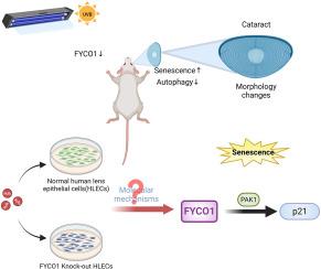 FYCO1 regulates autophagy and senescence via PAK1/p21 in cataract