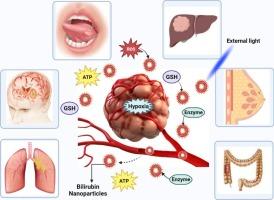 Utilizing stimuli-responsive nanoparticles to deliver and enhance the anti-tumor effects of bilirubin