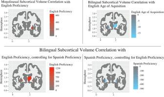 Subcortical volume and language proficiency in bilinguals and monolinguals: A structural MRI study