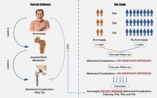 Mechanical complications and revision following total joint arthroplasty in acromegalic patients: A nationwide US-based study