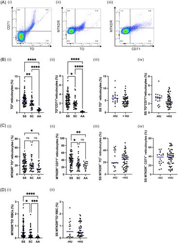 Mitochondrial retention in mature red blood cells from patients with sickle cell disease is associated with stress erythropoiesis but not with proinflammatory state